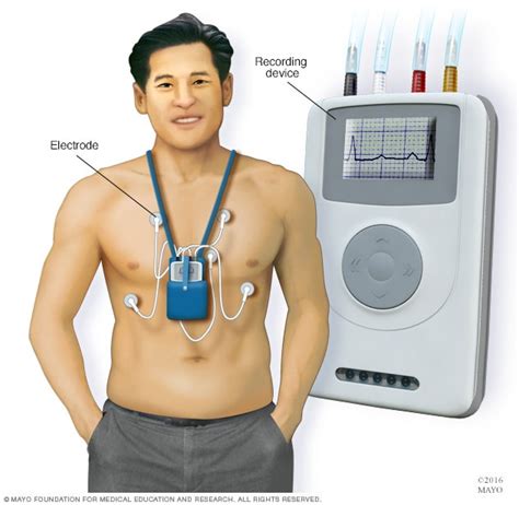 Holter Monitor Price